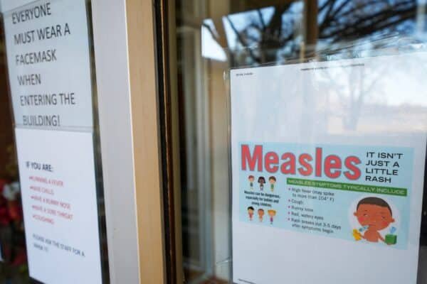 Measles cases linked to the outbreak in Texas reach 309, exceeding the national total in 2024